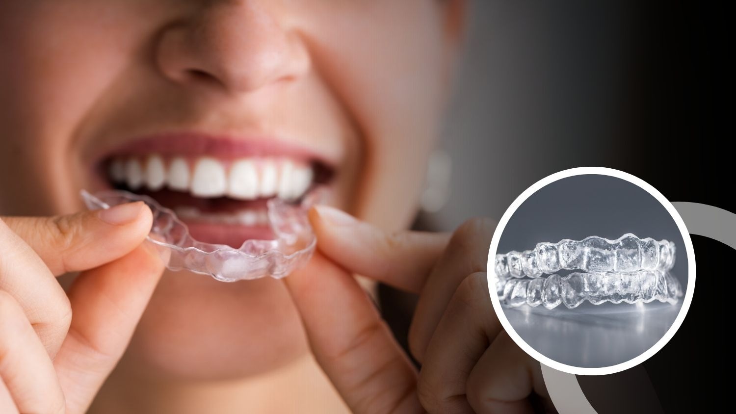 Invisalign – A Modern Orthodontic Approach from a Doctor’s Perspective